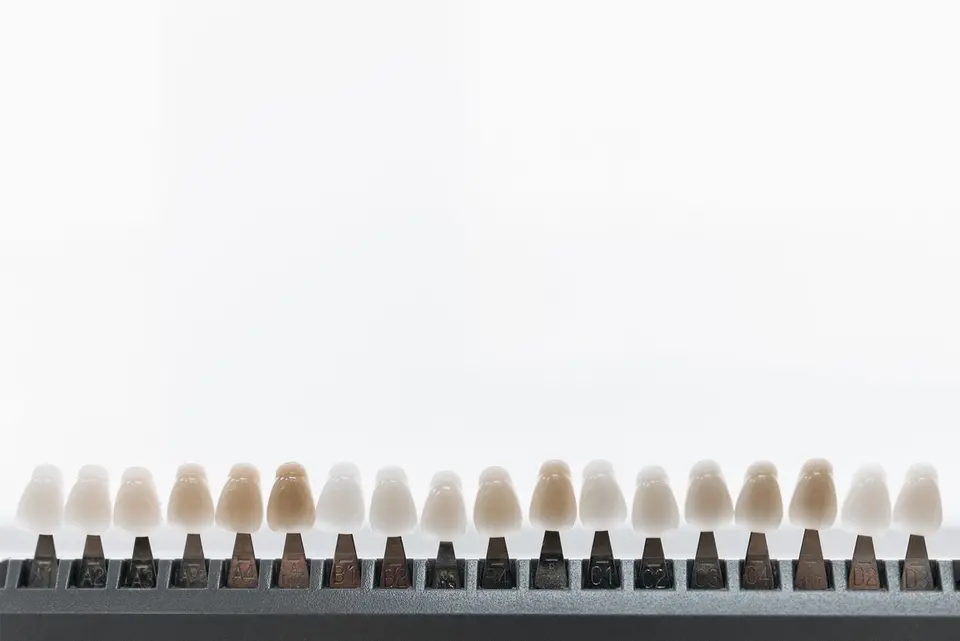 Close-up view of dental veneers on a display rack, showcasing various shades.